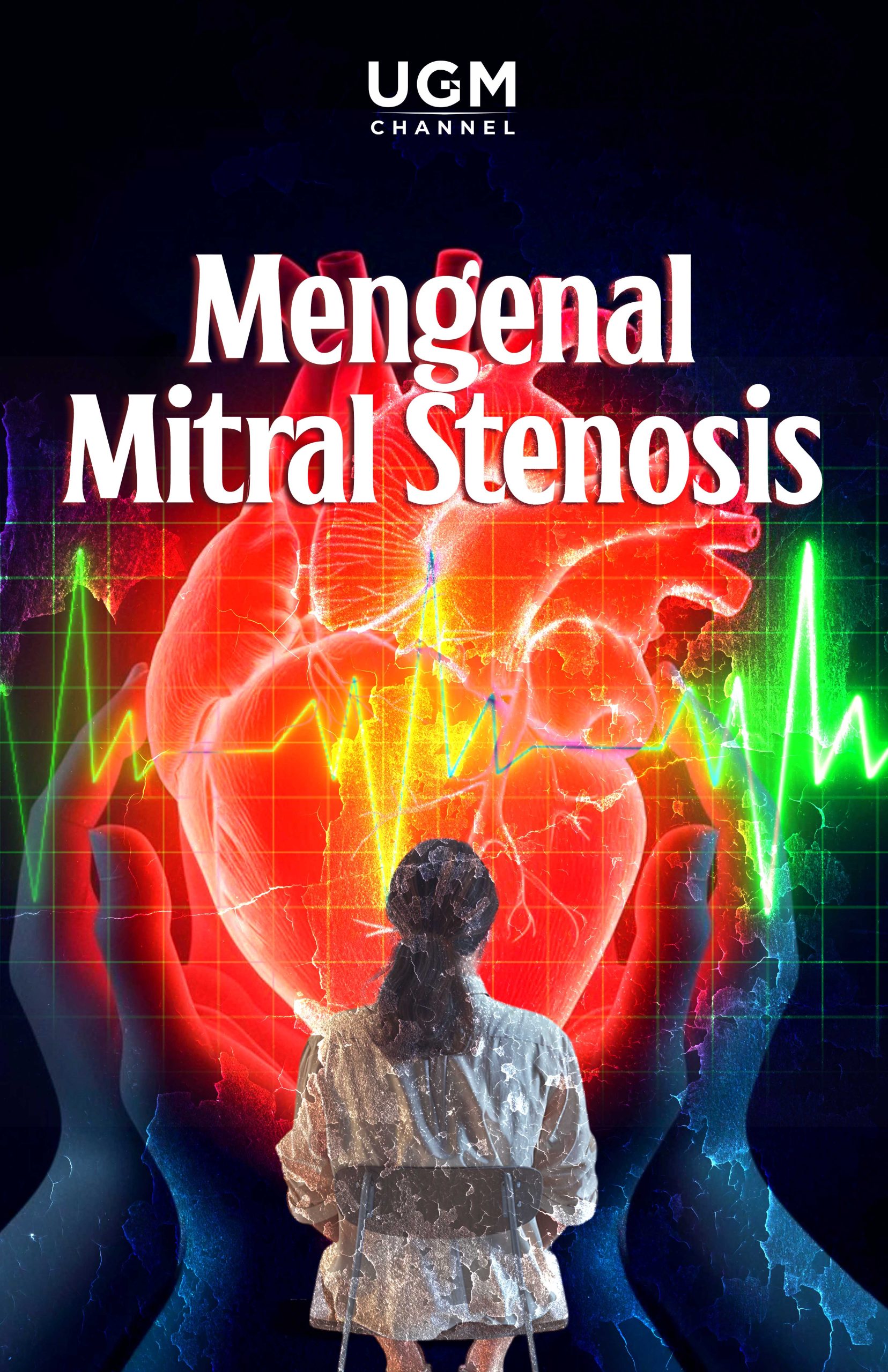 Mengenal Mitral Stenosis